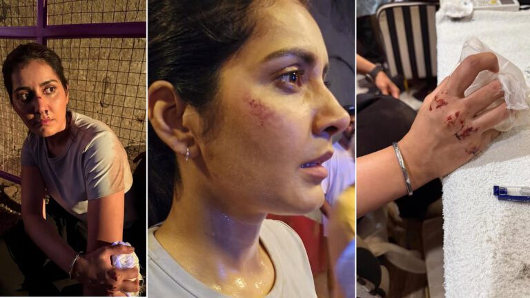 తీవ్ర గాయాలపాలైన స్టార్‌ హీరోయిన్‌!