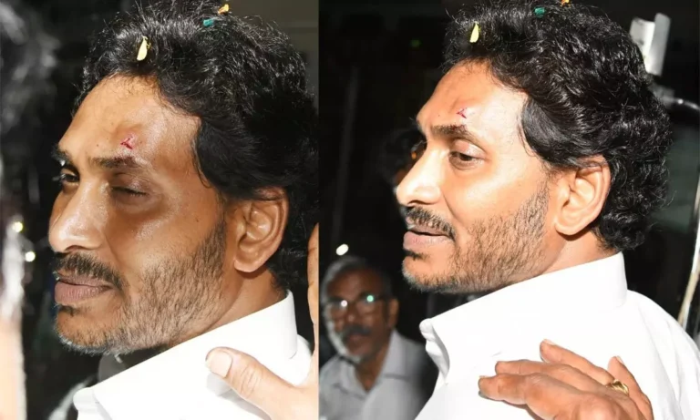 YSRCP In Defence After Blaming TDP For Jagan’s Stone Injury!