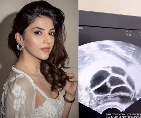 Mehreen Pirzada Shows Her Journey On Freezing Her Eggs